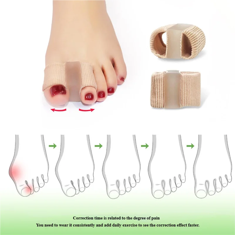 اثنين فاصل أصابع القدم أروح الورم مصحح تقويم العظام قدم العظام الضابط الإبهام مستقيم باديكير أدوات العناية بالقدم #2