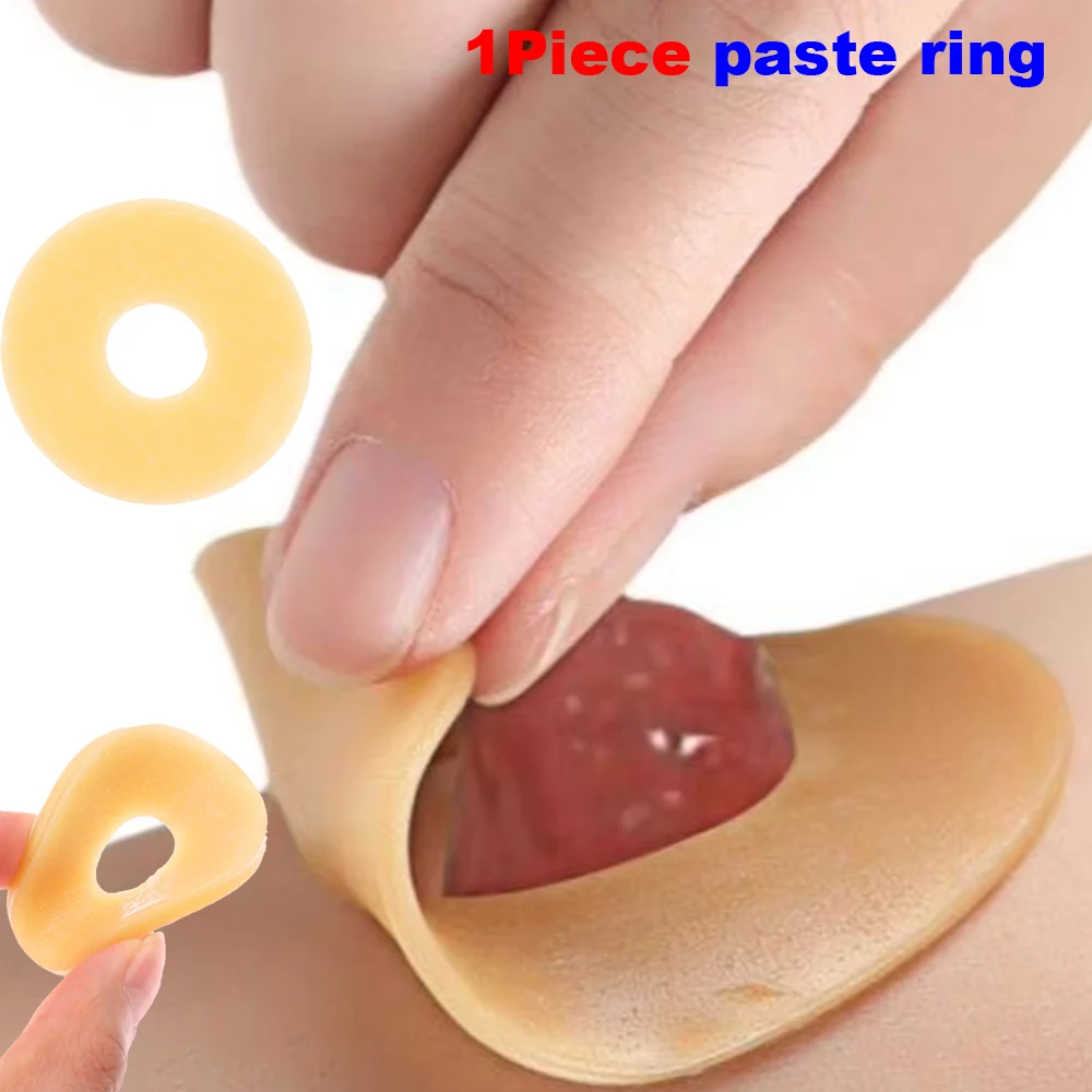 1 Piece Colostomy Bags Anti-leak Ring Portable for Stoma Bags Supplies Protective Barrier Rings Ostomy Bag Assistance