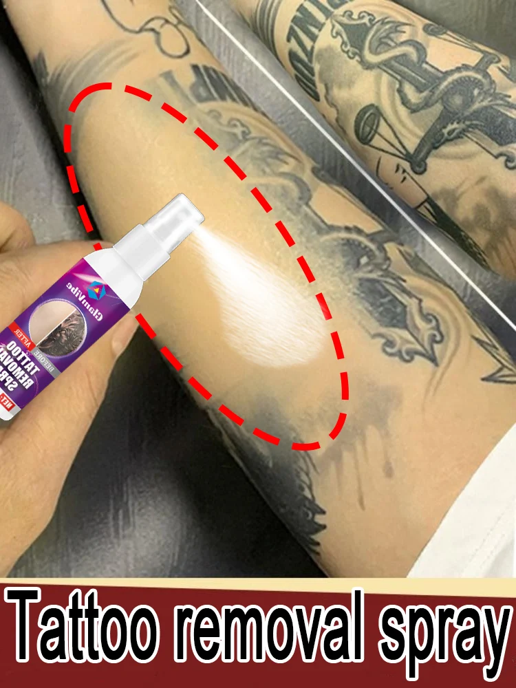

Clean stubborn tattoos, spray once a day, remove tattoos painlessly