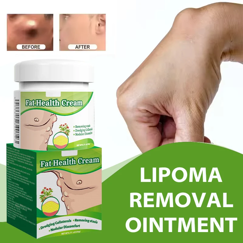 

20g Soothing Ointment Subcutaneous Lumps Remover, Fat Lump Skin Hard Mass Fat Nodules Body Fat Clumping Lipoma Removal Cream