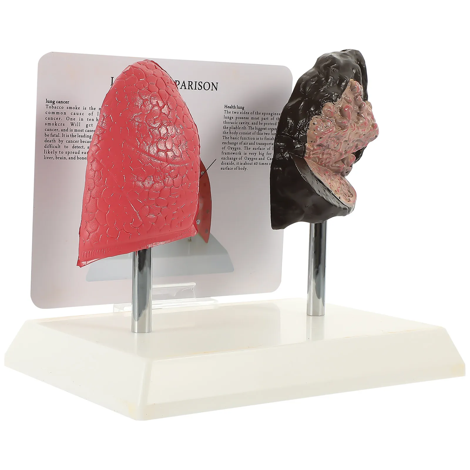 

1 шт. Учебная модель легких: сравнение легких курильщика и здорового человека, анатомический образовательный инструмент для изучения дыхательных путей, сравнительная модель