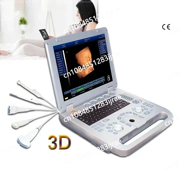 

Portable 3d Ultrasound Machine Medical Scan Digital Pseudo Color Usg 4d Optional Ecography