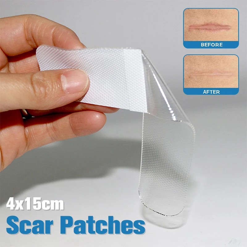 4x15cm Scar Patches Remove Silicone Gel Sheet Treatment Patch Ear Correctors Burn Wounds Efficient Surgery Scar Tape Skin Repair