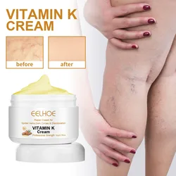 Vitamin K Cream Herbal Medicine Vein Massage Care Relieve Leg Soreness and Swelling Earthworm Leg Skin Care Cream