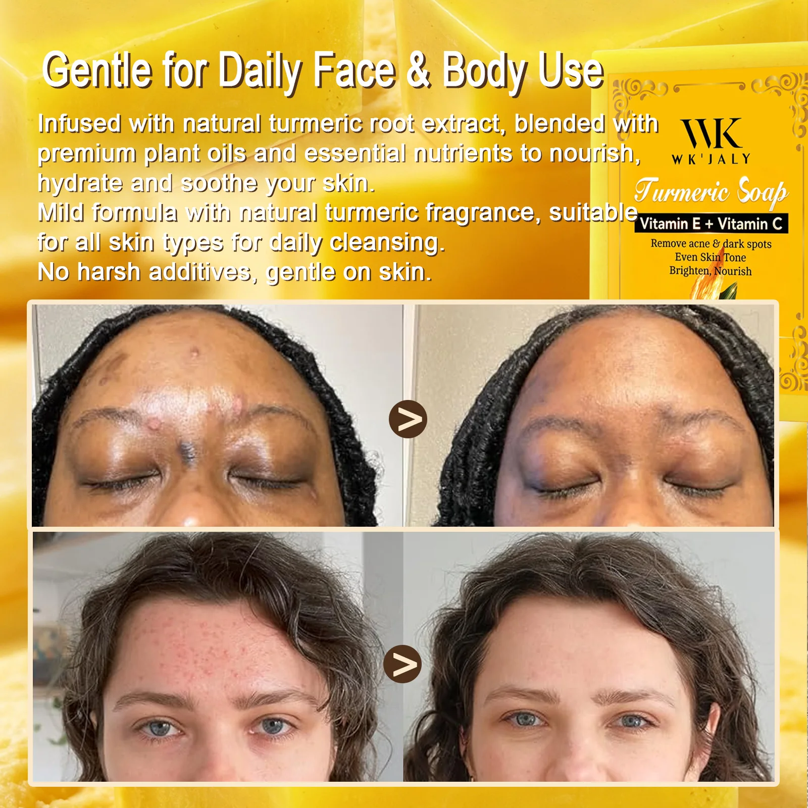 WK JALY Natural Turmeric Soap, Brighten Dull, Uneven Complexion, Fade Acne, Dark Spots, Hyperpigmentation, With Vitamin C, 200g