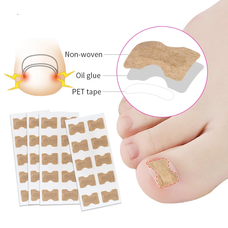 2Sheet Nail Feet Corrector Sticker Disposable Invisible Nail Toe Corrector Anti-Friction Pads Ingrown Toenail Corrector Patches