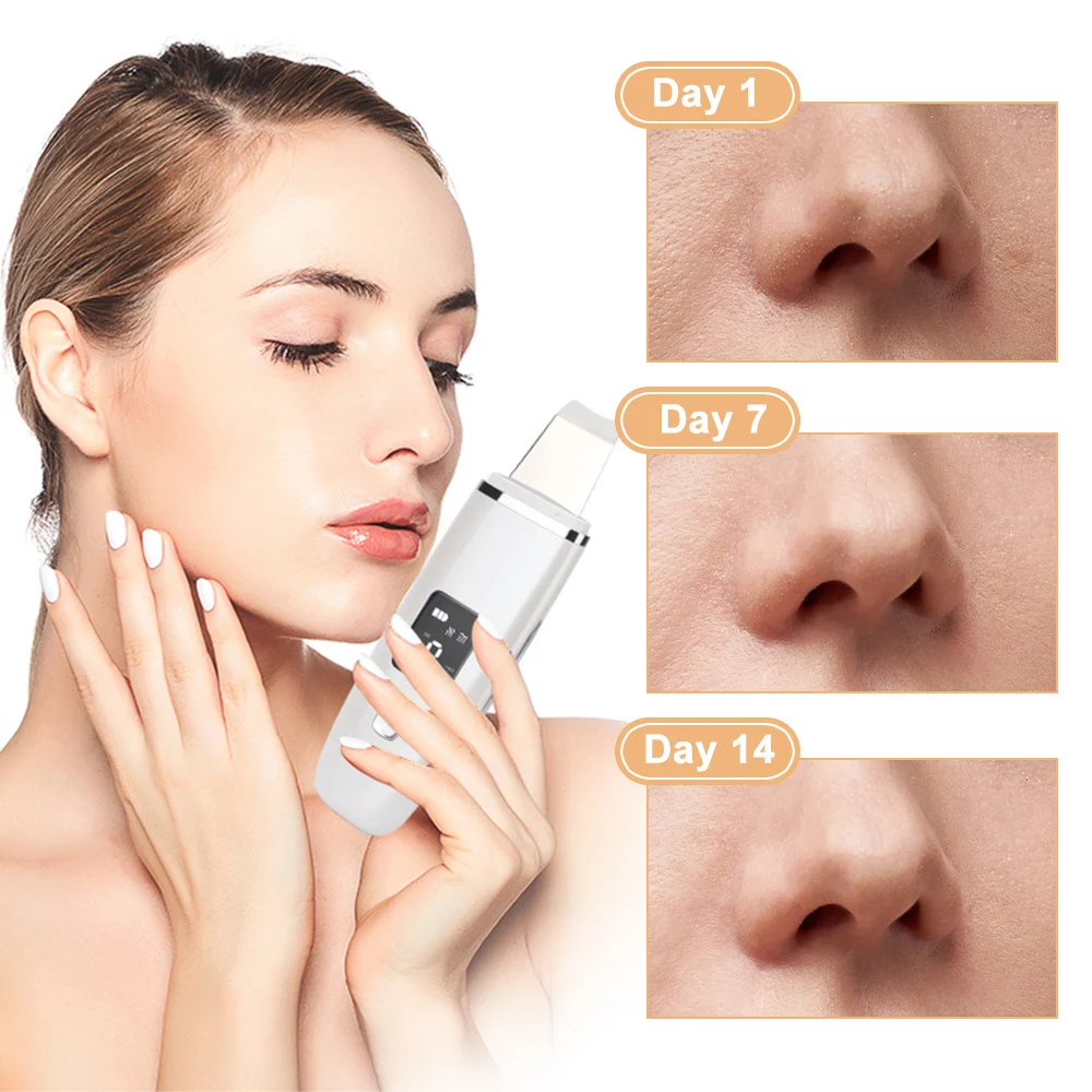 Ultrasonic Scrubber Blackhead Removal Facial Deep Clean Beauty Machine Exfoliating Reduce Wrinkle Face Lifting Massage Device