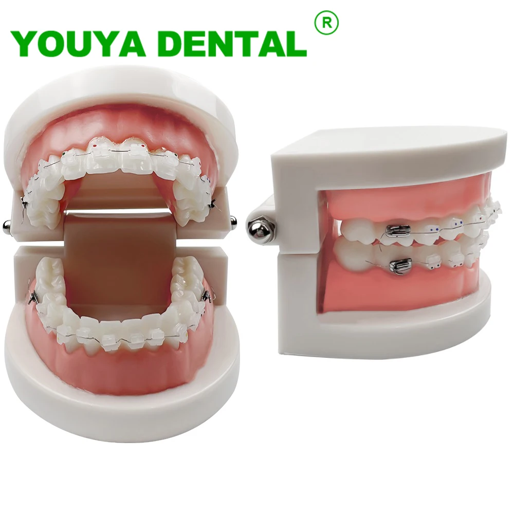 

Dental Orthodontic Teeth Model With Ceramic Braces Bracket Dentistry Ortho Treatment Demonstration Model For Patient Education