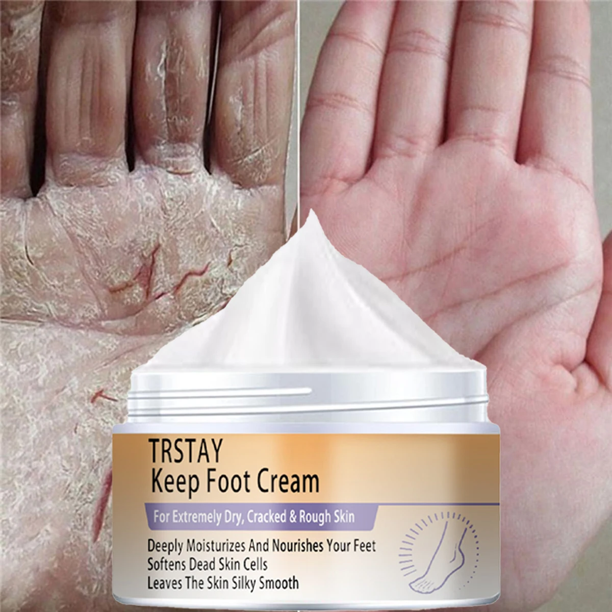 Cracked Heel Balm Cream for Rough Dry Cracked Chapped Hand/Feet Heel Skin Care Cream Natural Essence Skin Care for Body