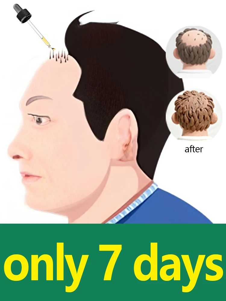 2025 رائجة البيع مشط فروة الرأس كرة دوارة صغيرة تدليك السائل دليل مشط مع زيت نمو الشعر سريع الاستخدام