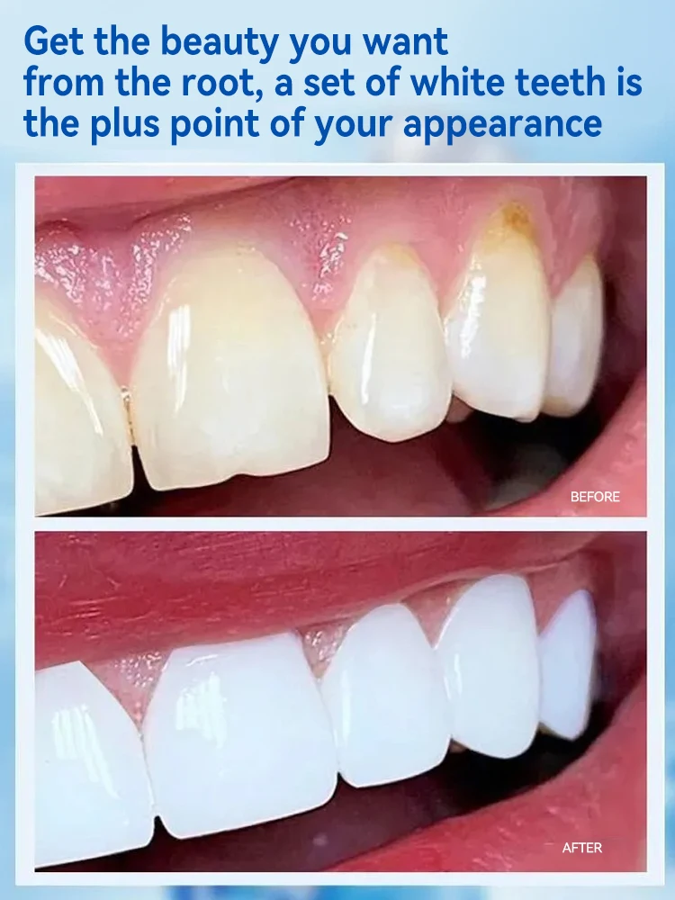 2025 nuevo, herramientas para el cuidado de limpieza de dientes, espuma oral, envío gratis