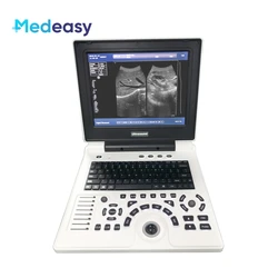 12 Inch Portable Notebook B Ultrasound Scanner Echo Machine Full Digital Diagnostic Device