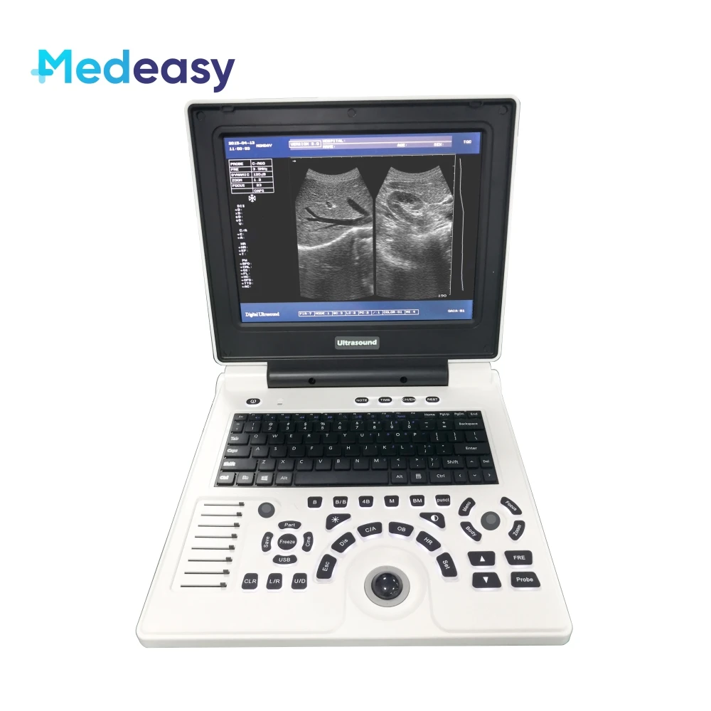 12 Inch LED Laptop Portable B Ultrasound Scanner Echo Machine Full Digital Diagnostic System