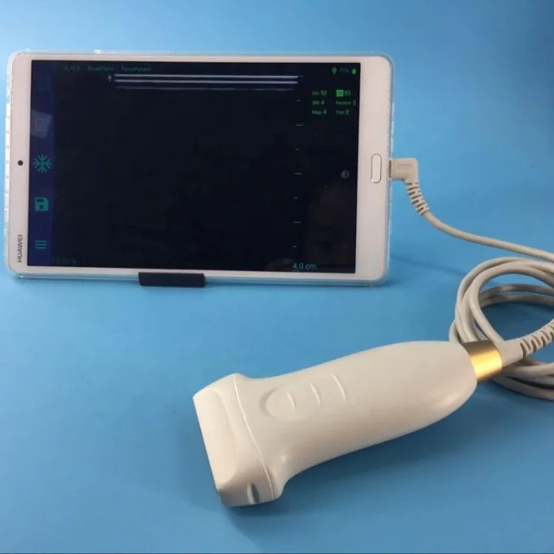 Portable 7.5Mhz USB linear probe ultrasound transducer best price USB ultrasound probe