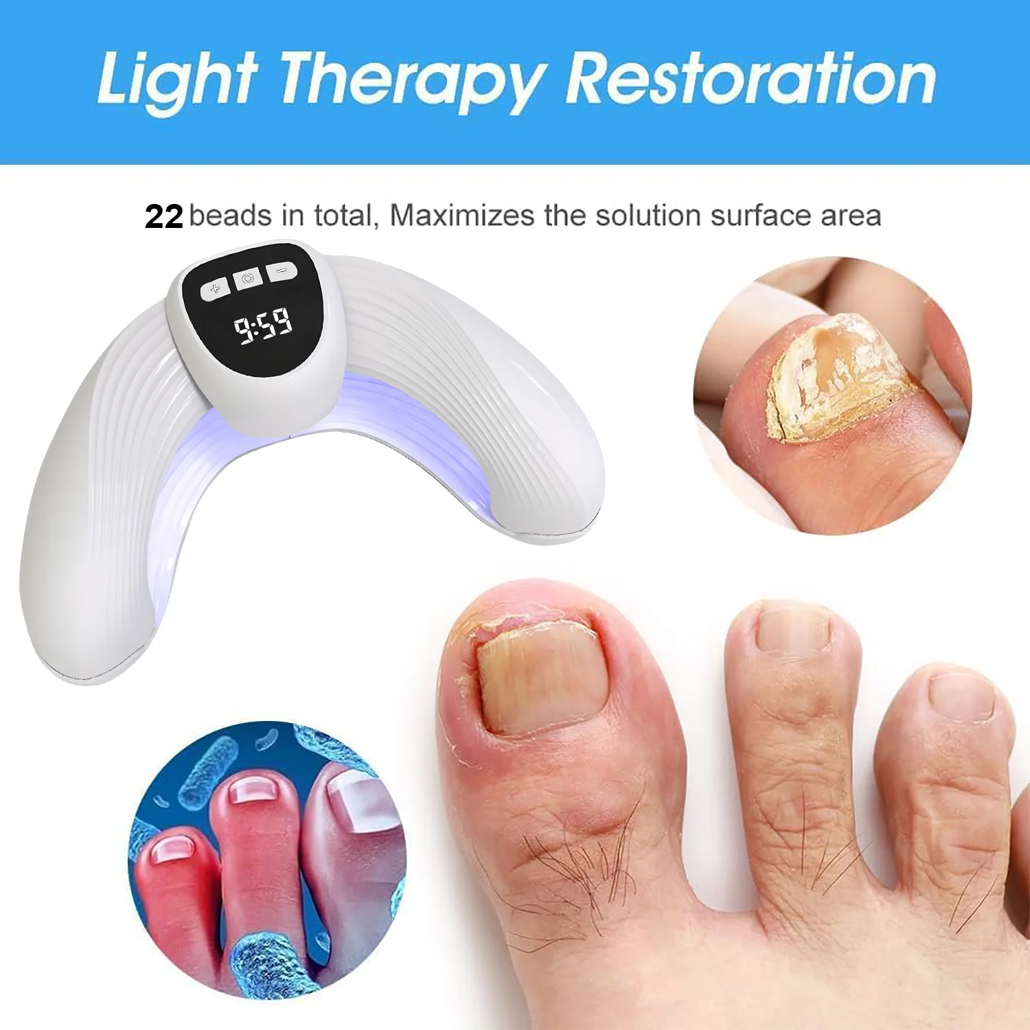 Nagelfototherapielamp Snelle reparatie van onychomycose voetverzorging om nagelschimmel nagellamp LED-display te elimineren