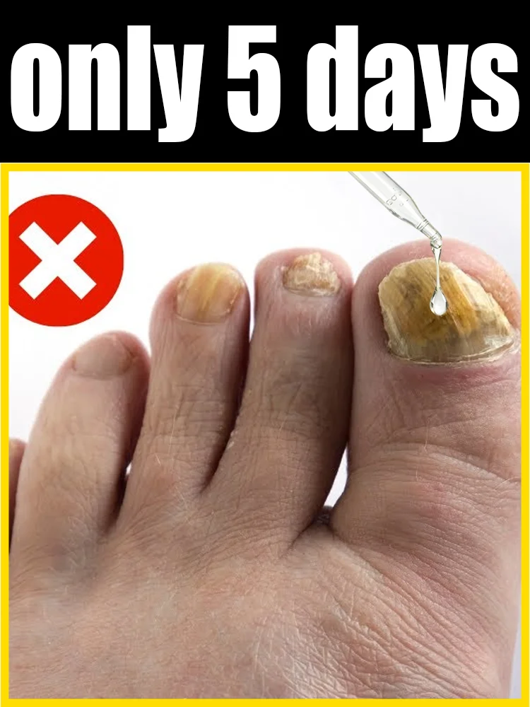 

Wave goodbye to dull, ridged nails and cultivate smooth, shiny ones.