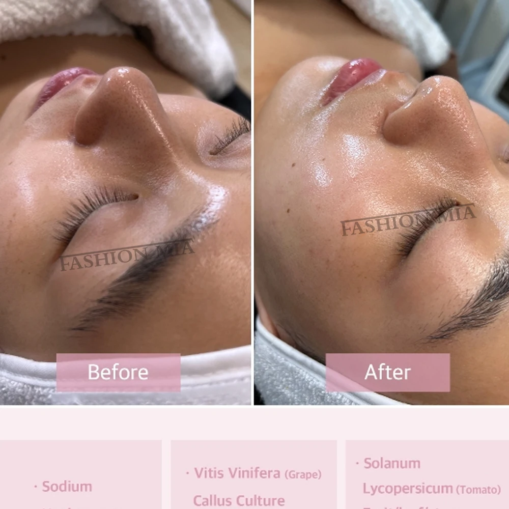 كوريا 8 مللي أكوا الجذعية ثقافة الخلية أمبولة مجموعة مصل الوجه حمض الهيالورونيك تبييض ترطيب تقليص المسام العناية بالبشرة