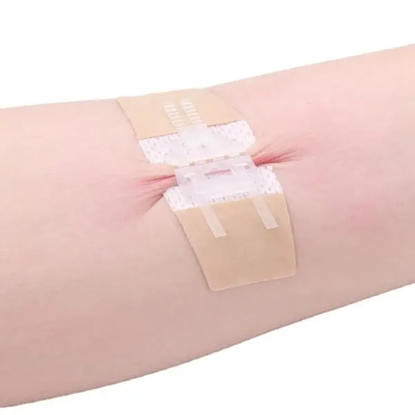 Suture-Free  Closure Stitching Stapler Zip Wound Strip Reinforced Non-invasive Adhesive Wound  Closure Device