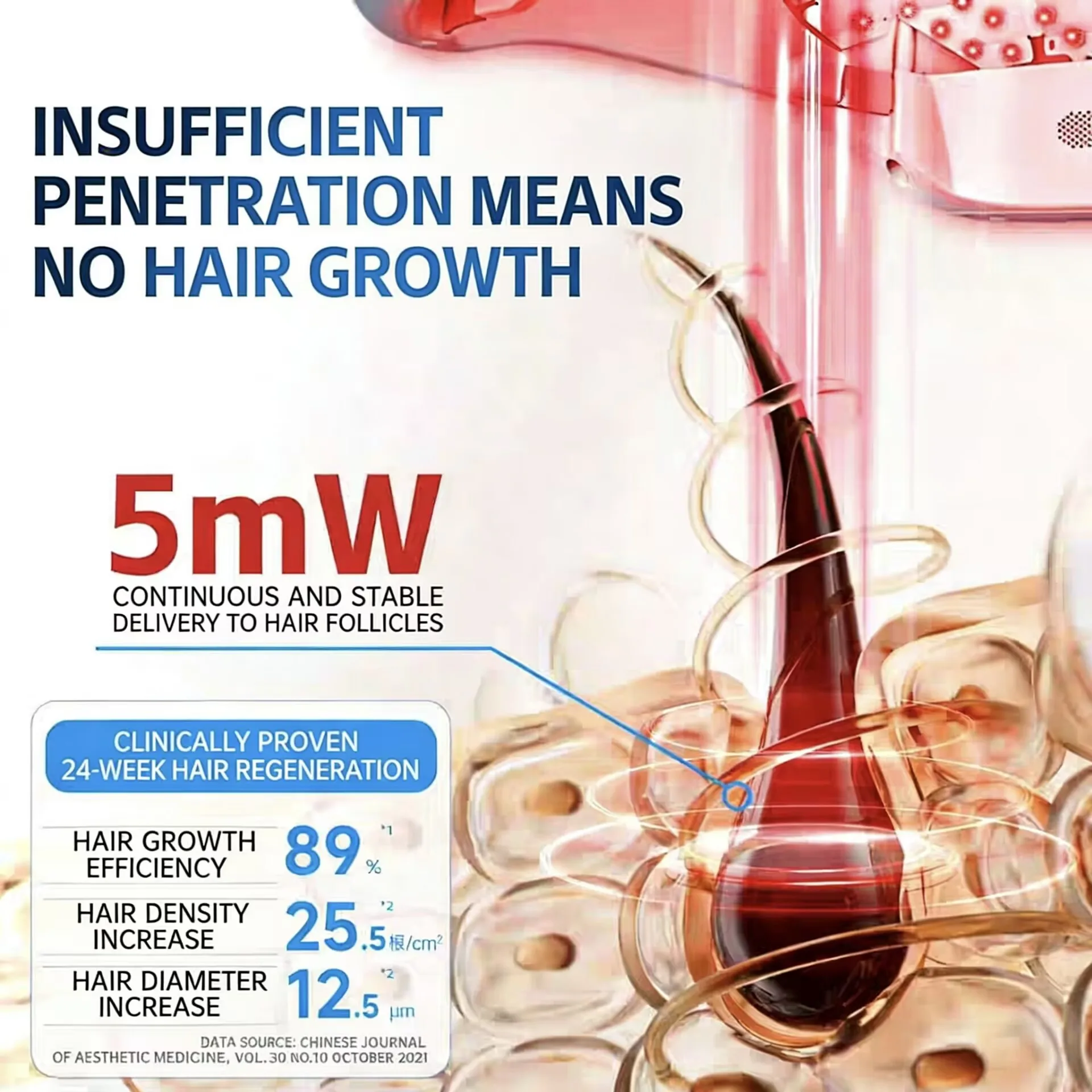 

Шапка для роста волос с красной светотерапией 650 нм, 300 лазерных диодов LLLT, интеллектуальное управление, лечение выпадения волос