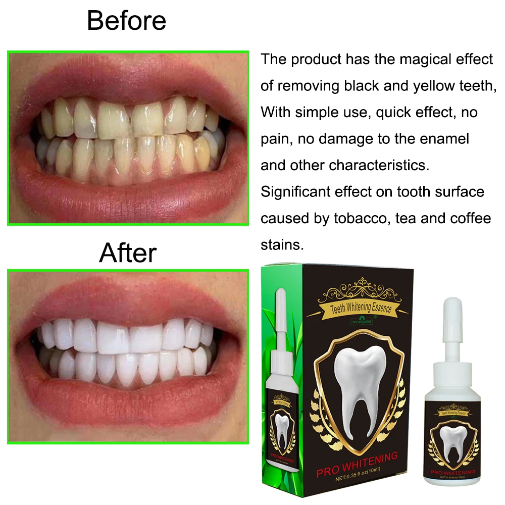 Teeth Whitening Essence Powder Clean Oral Hygiene Whiten Teeth Remove Plaque Stains Fresh Breath Oral Hygiene Dental Tools