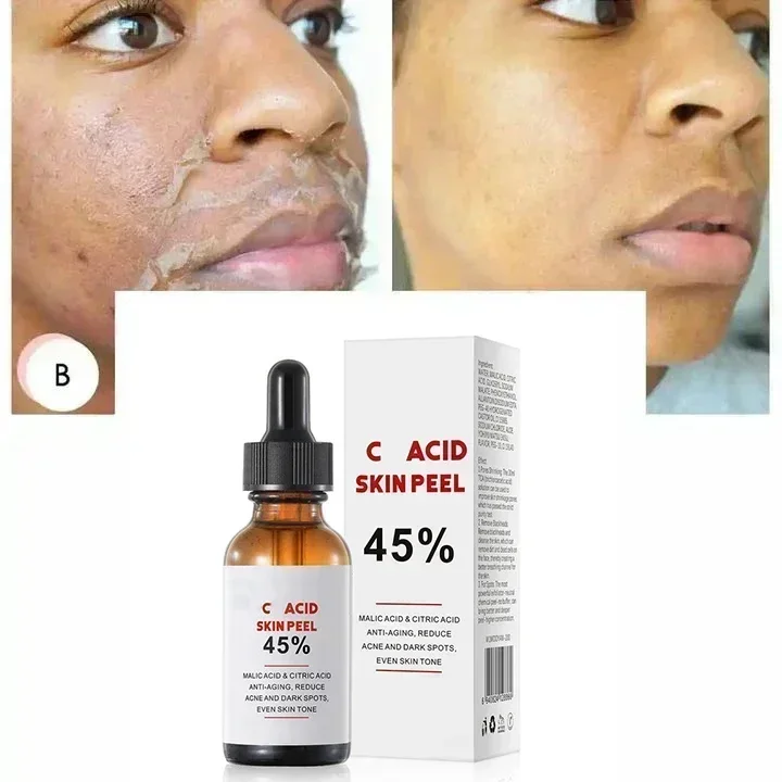 Gesicht Peeling Gel Tiefen reinigung Poren sanftes Peeling Öl Kontrolle glatt weich Gesicht Gesichts peeling Haut feuchtigkeit spendend