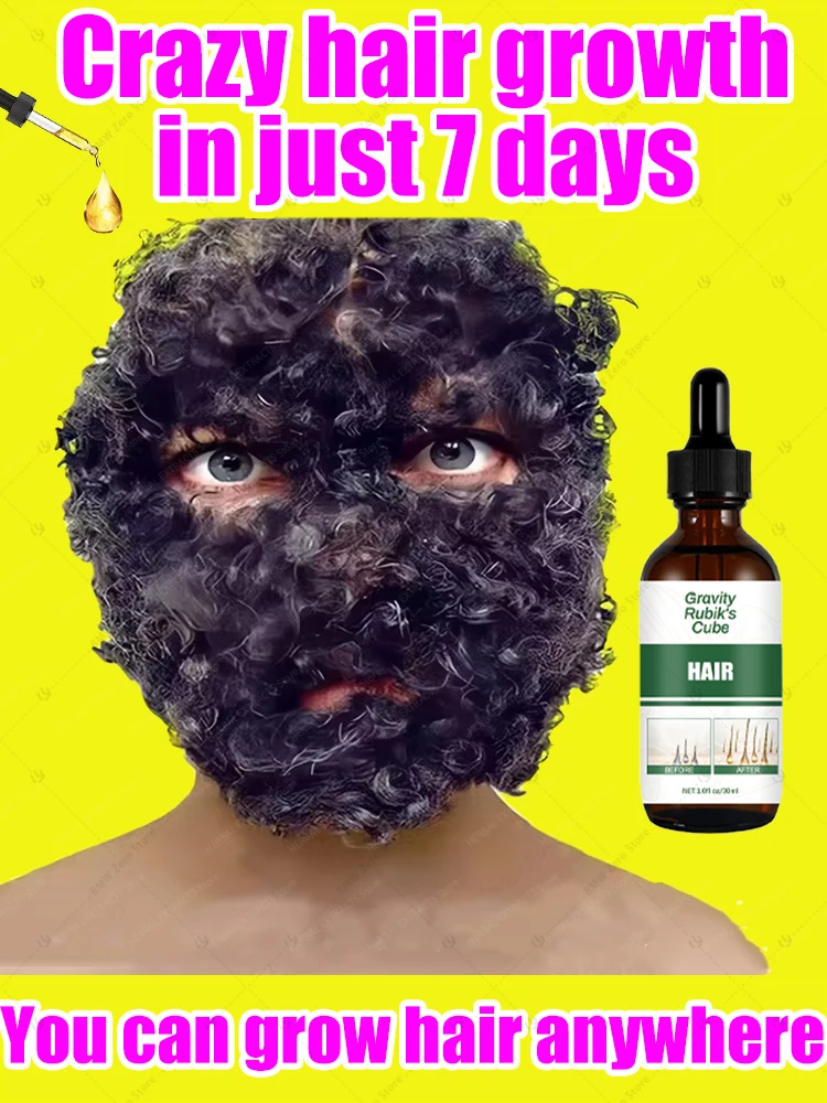 منقذ الصلع، يستعيد شعرك الأسود السميك بسهولة، ويستعيد ثقتك، ويعود إلى ذروة الفراغ #1