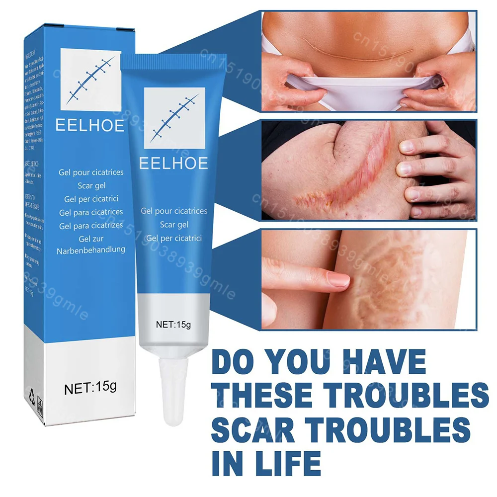 15G Erholung Narben Creme Schnelle Entfernung Haut Narben Behandeln Chirurgie Narben Dehnungsstreifen Akne Pocken Drucke Brennen Reparatur gesichts Pflege Gel