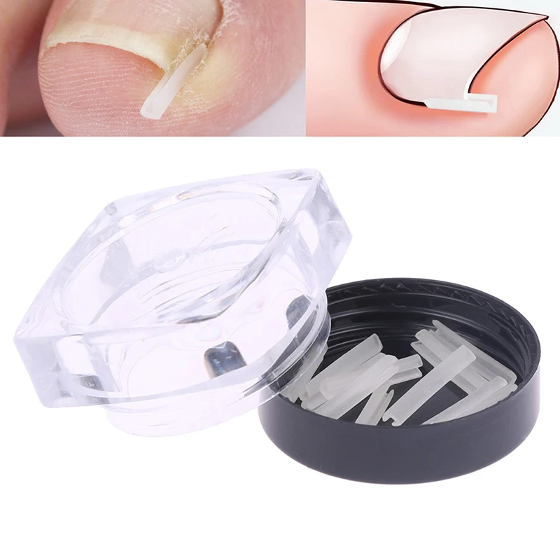 10 Stuks Plastic Ingegroeide Neus Nagelkussens Onzichtbare Nagel Correctie Stickers Paronychia Herstellen Pedicure Gereedschap Voetverzorging