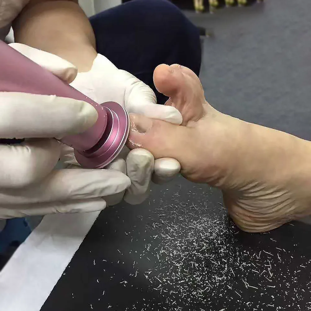 

120Pcs Replacement Sandpaper Discs Foot Callus Remover Tool Ergonomic Design for Smooth Feet Sanding Disc