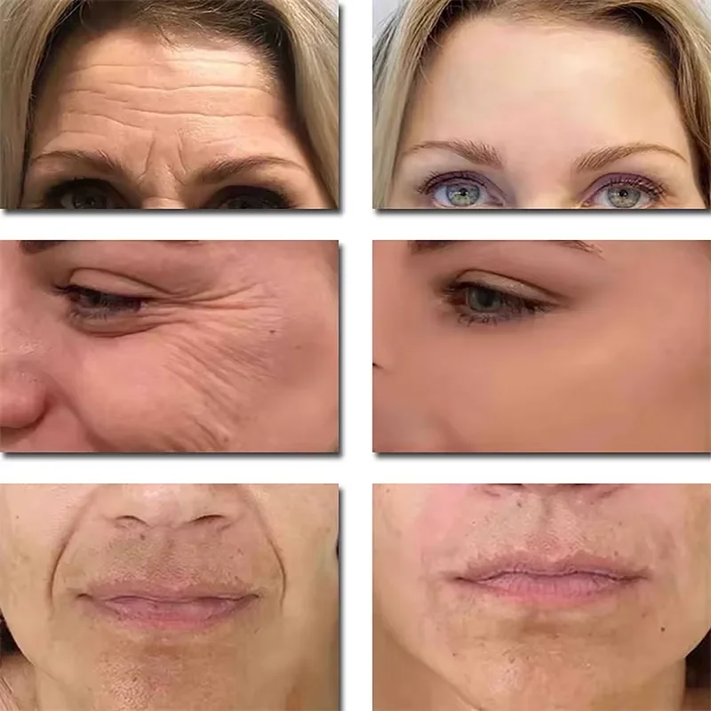 سيول 1988 2% مصل شبكي مضاد للشيخوخة والتجاعيد الجينسنغ جوهر الوجه ثبات المسام اشراق مرطب الوجه العناية بالبشرة الكورية #2