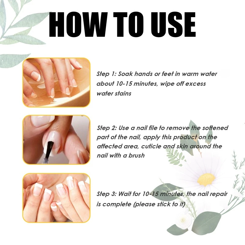 Nail repair essence Fungus Treatment onychomycosis hand care feet fungal removal soft nails thickening brighten Anti infective