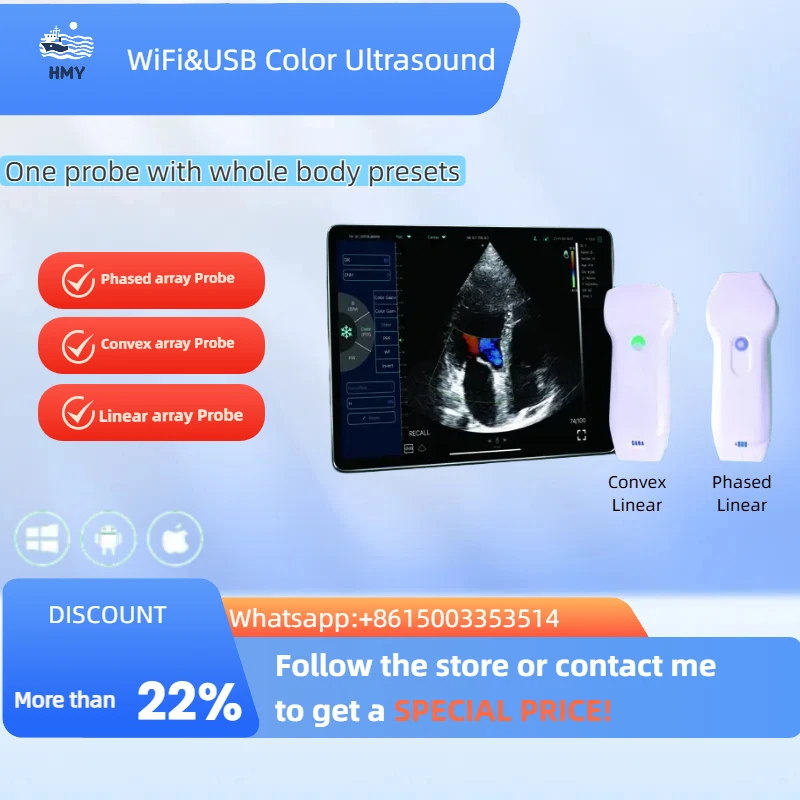 Новый стиль портативный цветной доплеровский медицинский беспроводной ультразвуковой датчик 3 в 1 Новый стиль портативный цветной доплеровский медицинский беспроводной ультразвуковой датчик 3 в 1