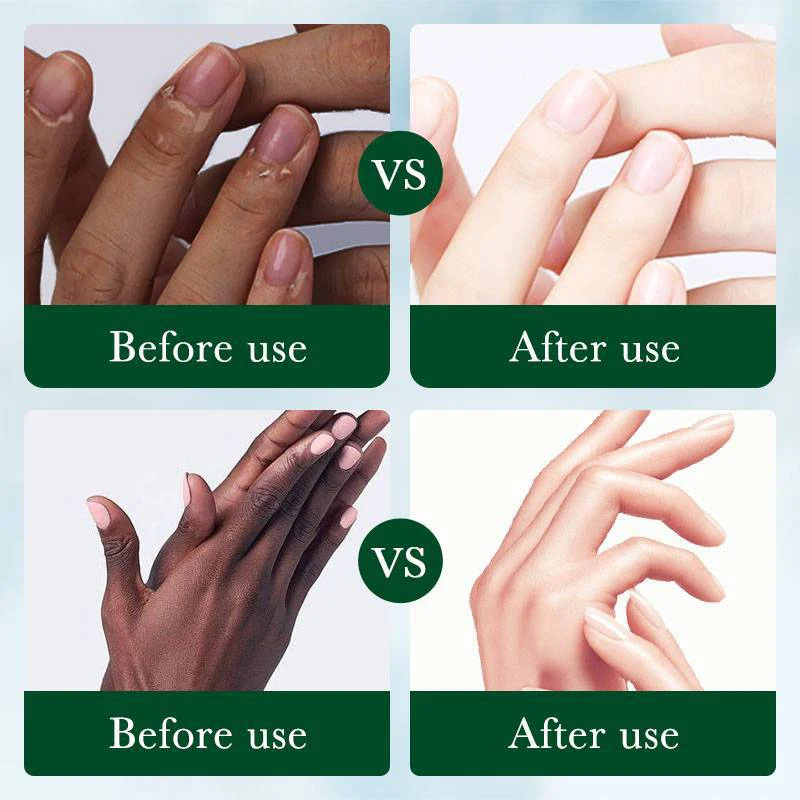 Fast Whitening Dark Knuckles Hand Cream Brighten Moisturizing Intense Stains Remover Melanin Corrector Products Hand Skin Care