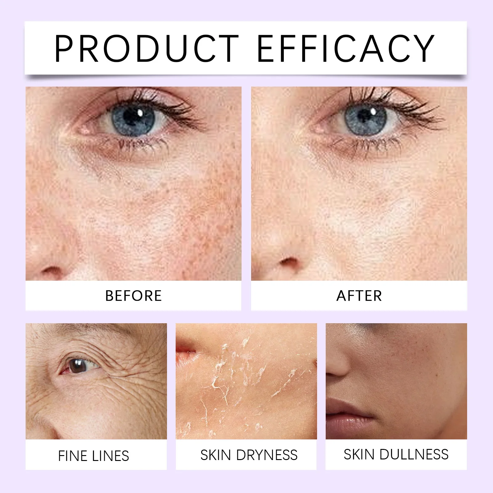 مرطب الوجه مع حمض الهيالورونيك كريم يومي خفيف الوزن للبشرة الجافة غسول وجه لطيف للبشرة الحساسة 50 جرام