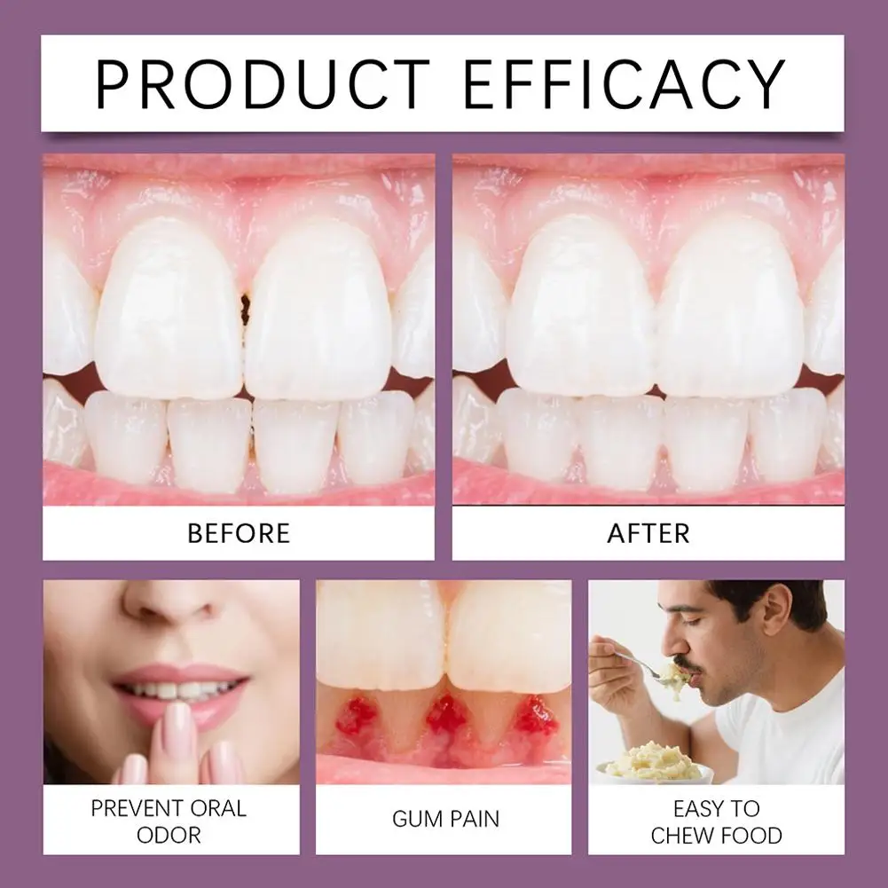 Thermoplastic Denture Adhesive 40g Denture Grip Adhesive Long-Lasting Soft Reliner Tooth Glue For Women Men Adults