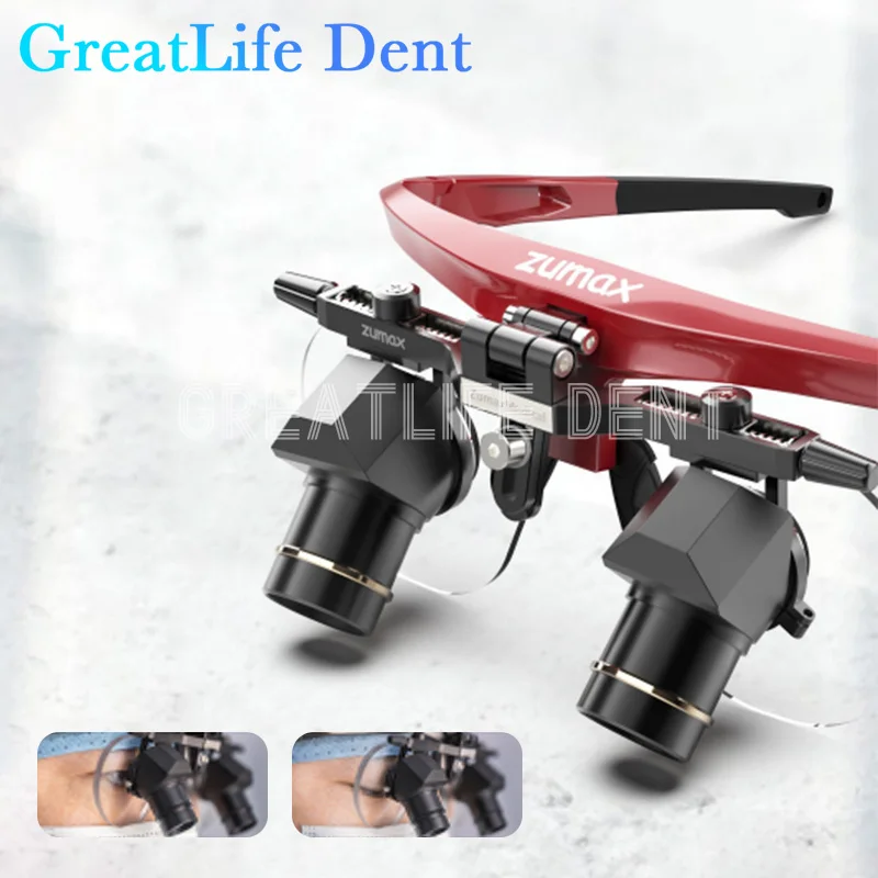 GreatLife Dent 3X4X5X ZUMAX DFK Dentisit Surgical Headlight Surgery Beyond Vision Dental Magnifier Refractives Binocular Loupes