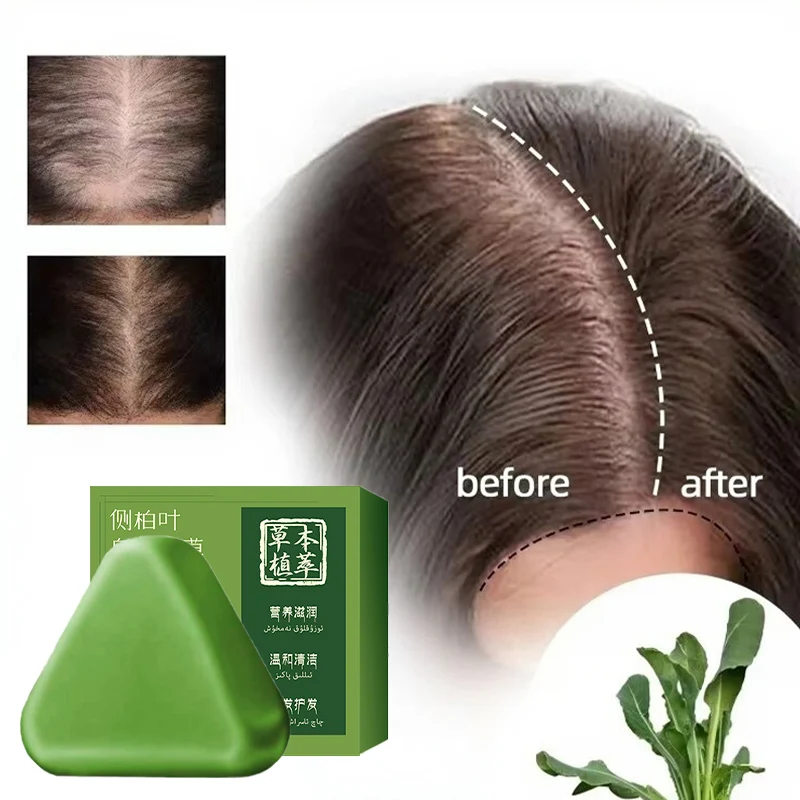 

New 12 Types Plant Shampoo Bar Hair Growth Anti-hair Loss Solid Shampoo Natural Botanicals Essential Oils Controls Oil Dandruff