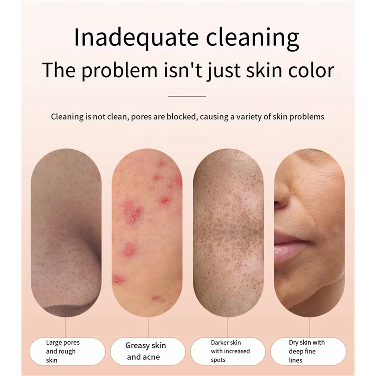 Removedor de cravo elétrico rosto espinha extração manchas profundas poros acne remoção limpador Cleanser-A70Z