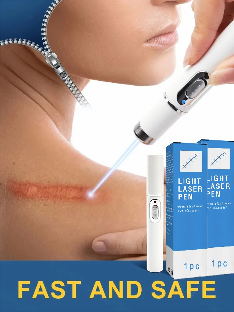 العلاج بالليزر Keloid Scar تحسين Keloid Scar Pen Scar Relief سهل مؤشر ليزر غير ضار