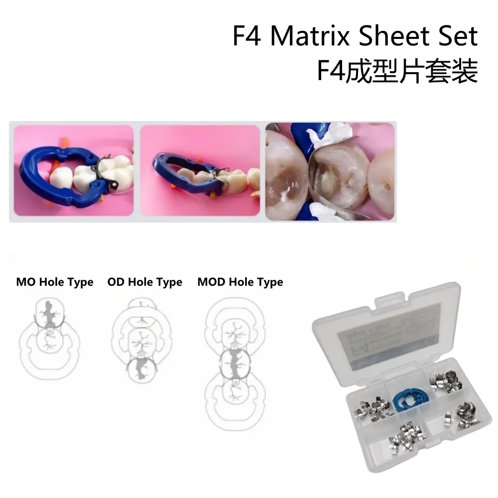 Dental Sectional Matrix System F4 Metal Contoured Matrices Bands Resin Clamping Ring Forming Sheet 52Pcs/Set