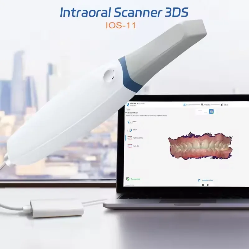 Digital Intraoral Sensor Scanner 3D Scanner with Software Real Color CAD CAM 3D Scanner