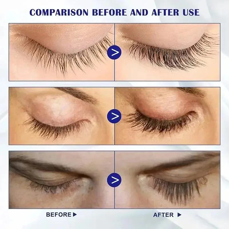 Sérum à croissance rapide pour les cils, traitement naturel pour friser les cils, allonger les cils, maquillage injuste, produits de soins liftants