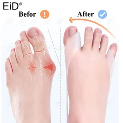 EiD Big& small Toe Separator Hallux Valgus Bunion Corrector Hammer Toe Straightener Foot Pain Relief Orthopedic Pedicure Tools