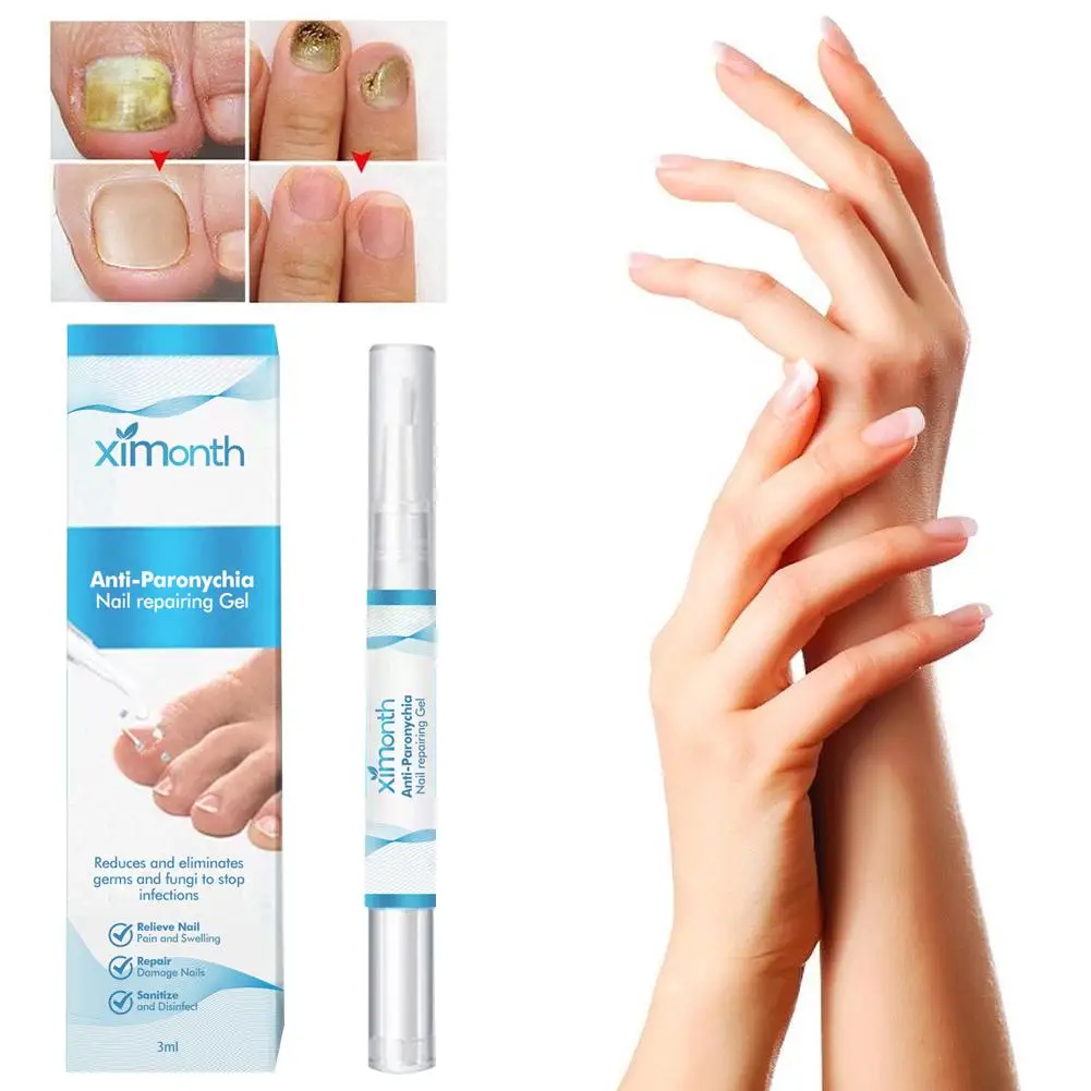 Nail Toenails Nail Repair Pen Anti Care Repair Serum Painless Nail Health For Thicked Broken Discolored Nails R1M3