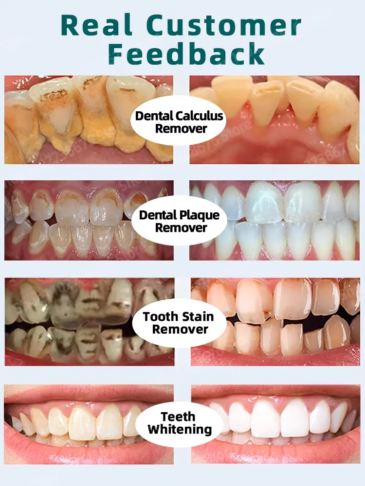 Resolver todos los problemas dentales ·