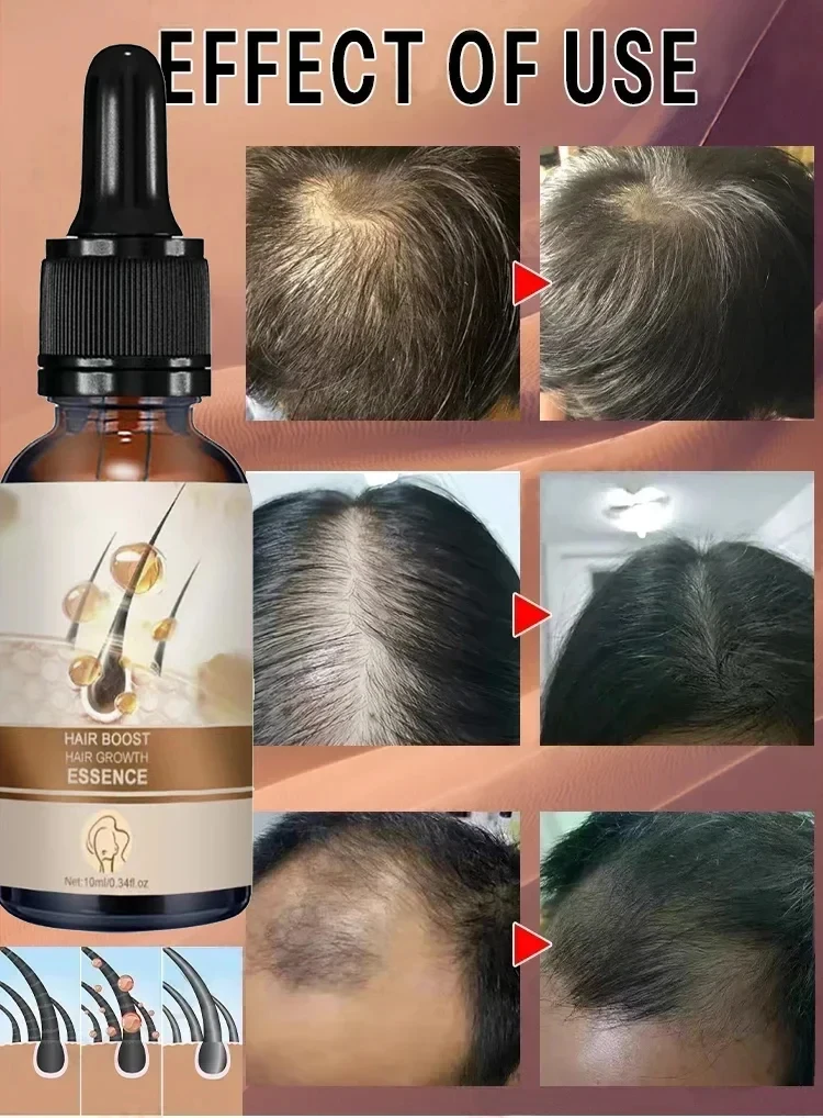 Unisex Hair Growth Oil Hair Loss Treatment Rapid Hair Growth Effective Baldness Repair Hereditary PostpartumHair Loss