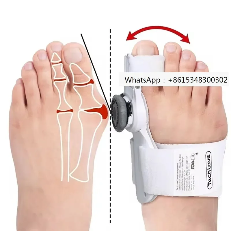 Multi-directional fixed foot Bunion Splint Separator Orthopedic Toe Corrector Adjustable Hallux Valgus For Foot Care Products