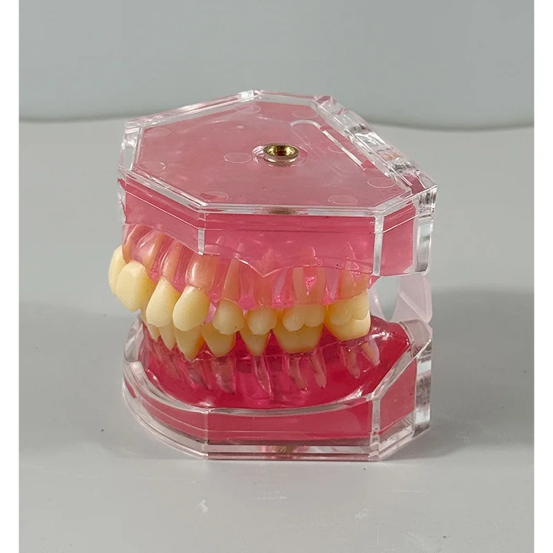 

Dental Standard Typodont Model With 28pc Removable Teeth Soft Gum Tooth Extraction Practice Model For Patient Education Demo New