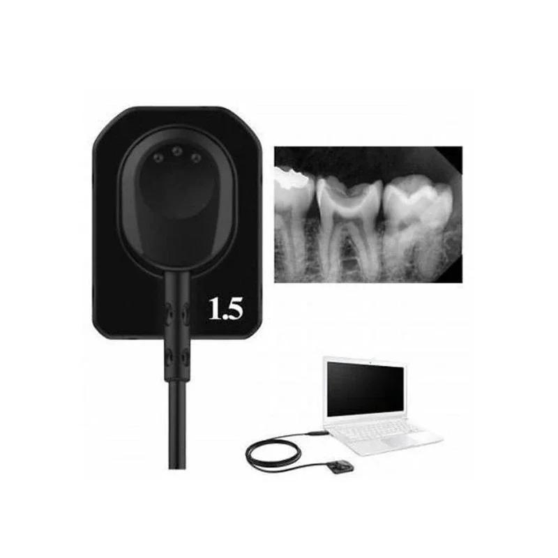 

digital oral X-ray sensor oral imaging system dental X-ray sensor R1/R2 with dental hospital