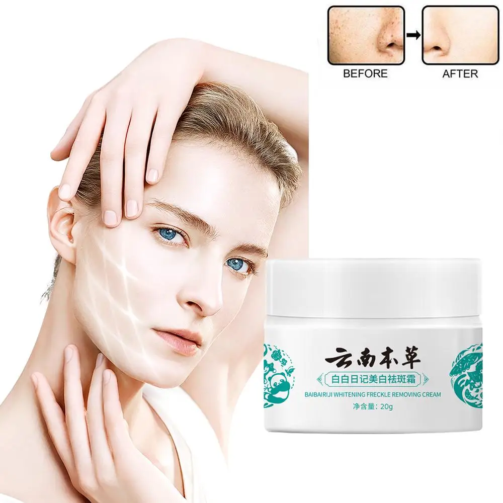 Yunnan Herbal Whitening Freckle Cream Effective Remove Skin Care Melasma Brighten Spots Cream Dark Remove Moisturize K1U4